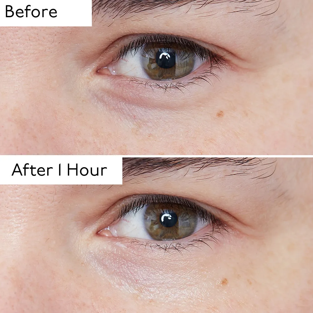 Hyaluronic Global Eye Serum