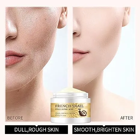 LAIKOU Snail Essence Face Cream Moisturizing Acne Scar Removal Cream Improve Skin Nourishing Collagen Essence Cream for Improve Damaged Skin S2838090