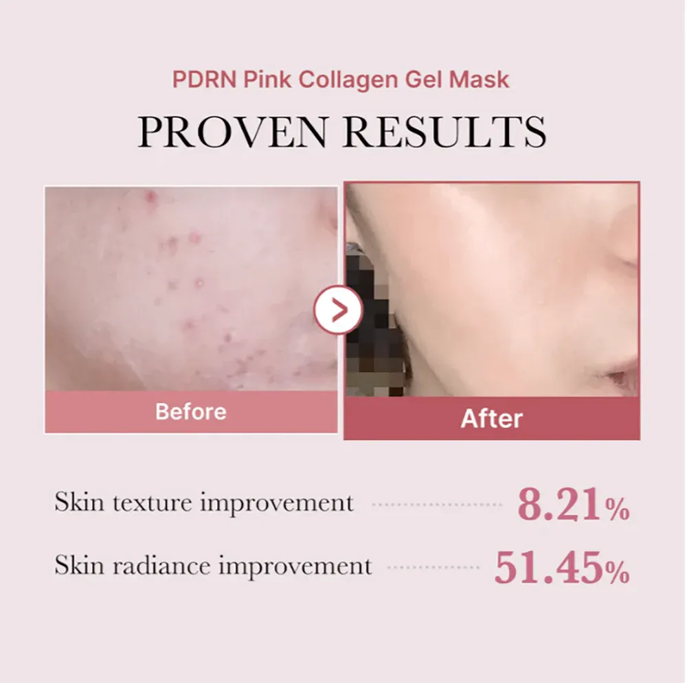 Medicube Pdrn Pink Collagen Gel Mask (1Ea)