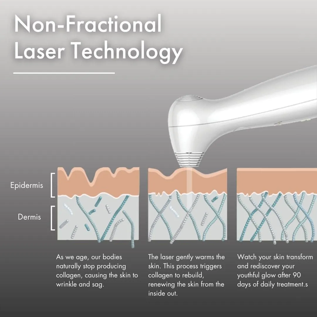 NIRA Pro Anti-Ageing Laser