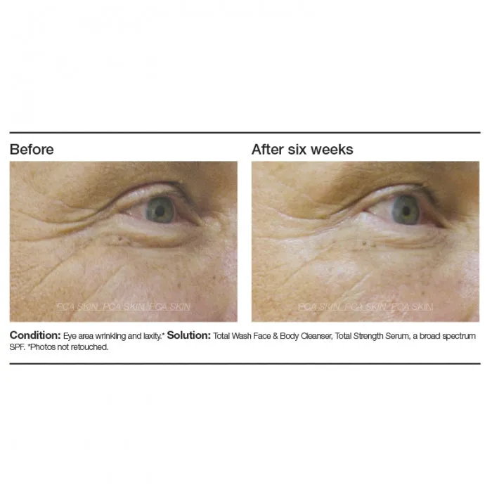 PCA Total Strength Serum
