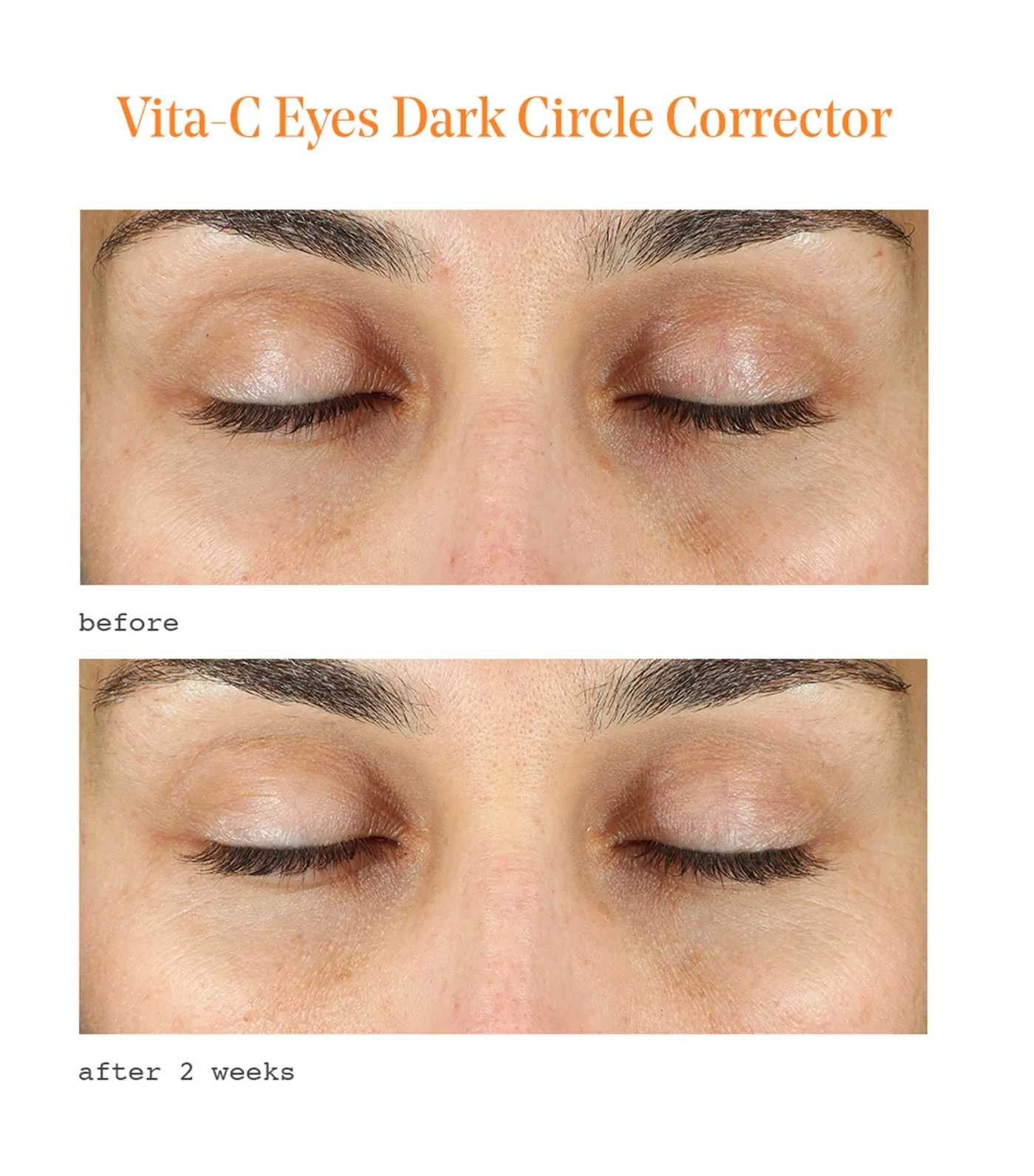 Vita-C Eyes Dark Circle Corrector